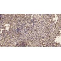 SOD-2 Polyclonal Antibody