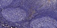 Somatotropin Polyclonal Antibody