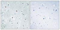 Sox-12 Polyclonal Antibody