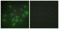 HKR1 Polyclonal Antibody