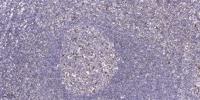 HKR1 Polyclonal Antibody