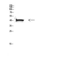 HLA Class I Polyclonal Antibody