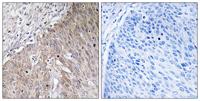ApoL2 Polyclonal Antibody