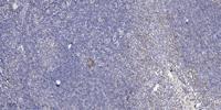ApoL3 Polyclonal Antibody