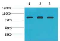 Actinin-α1 Polyclonal Antibody