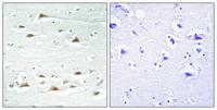 Actinin-α1/2/3/4 Polyclonal Antibody