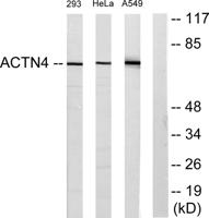 Actinin-α1/2/3/4 Polyclonal Antibody