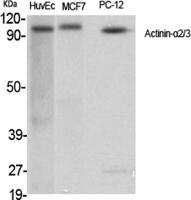 Actinin-α2/3 Polyclonal Antibody
