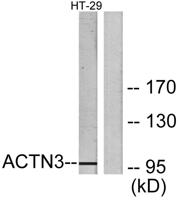 Actinin-α3 Polyclonal Antibody