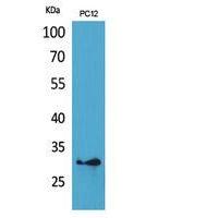 HLA-DQB1/2 Polyclonal Antibody