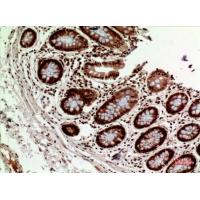 HLA-DQB1/2 Polyclonal Antibody