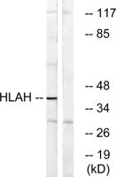 HLA-H Polyclonal Antibody