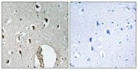 HLX1 Polyclonal Antibody