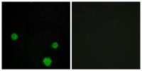 HLX1 Polyclonal Antibody