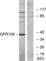 HM74 Polyclonal Antibody