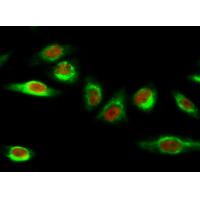 HMG-1 Polyclonal Antibody