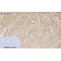 HMG-1 Polyclonal Antibody