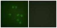 HMG-14 Polyclonal Antibody