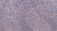 HMG-14 Polyclonal Antibody
