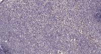 HNF-4α/γ Polyclonal Antibody