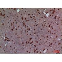 HoxD3 Polyclonal Antibody