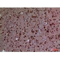 HoxD3 Polyclonal Antibody