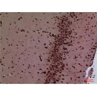 HoxD3 Polyclonal Antibody