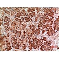 HPA1 Polyclonal Antibody