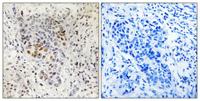 Sp1 Polyclonal Antibody