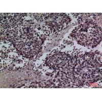 SP-A Polyclonal Antibody