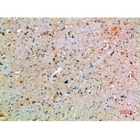 SPOP Polyclonal Antibody