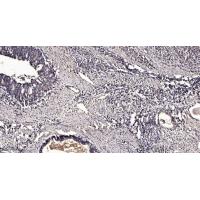 SPOP Polyclonal Antibody