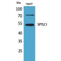 SPTLC1 Polyclonal Antibody