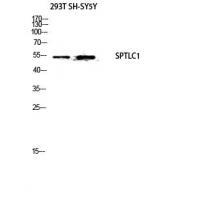 SPTLC1 Polyclonal Antibody