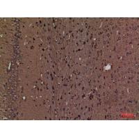 SPTLC1 Polyclonal Antibody