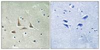 HSF-27 Polyclonal Antibody