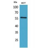 ALK-1 Polyclonal Antibody