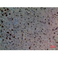 ALK-1 Polyclonal Antibody