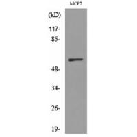 ALK-1 Polyclonal Antibody