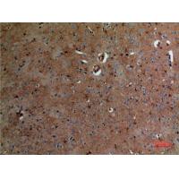 Aldolase C Polyclonal Antibody