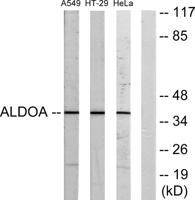 Aldolase A Polyclonal Antibody