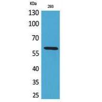 ALPP/ALPPL2 Polyclonal Antibody