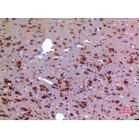 HSP 90 Polyclonal Antibody
