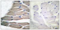 ACCα (phospho Ser80) Polyclonal Antibody