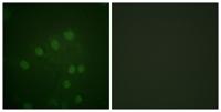 ARK-2 (phospho Thr232) Polyclonal Antibody