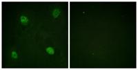 hnRNP D0 (phospho Ser83) Polyclonal Antibody