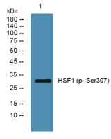 HSF1 (phospho Ser307) Polyclonal Antibody