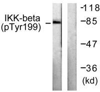 IKKβ (phospho Tyr199) Polyclonal Antibody