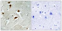 4E-BP1 (phospho Thr69) Polyclonal Antibody