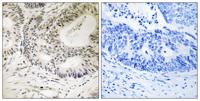 53BP1 (phospho Ser25) Polyclonal Antibody